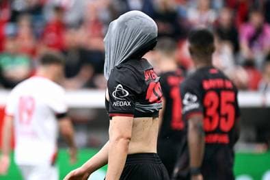 Böser Bayer-Patzer vor Bayern-Kracher