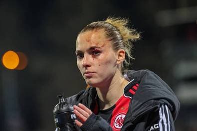 Schreckmoment um DFB-Stürmerinnen