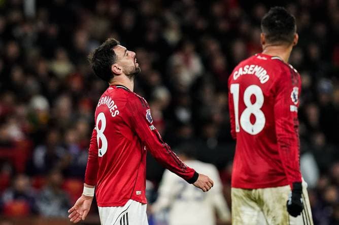 Nächster Rückschlag für United