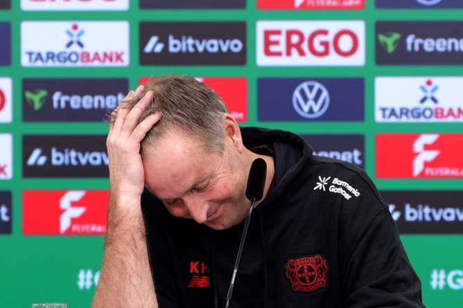 "Was suchst du?" Bayer-Coach wimmelt Kritik ab