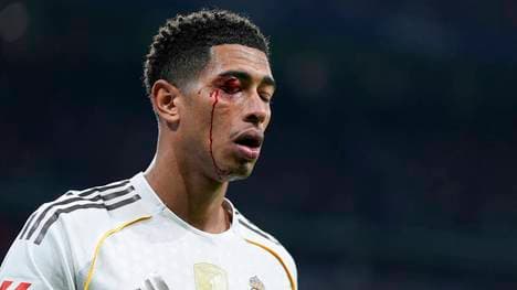 Jude Bellingham wurde mit dem Ellenbogen im Gesicht getroffen