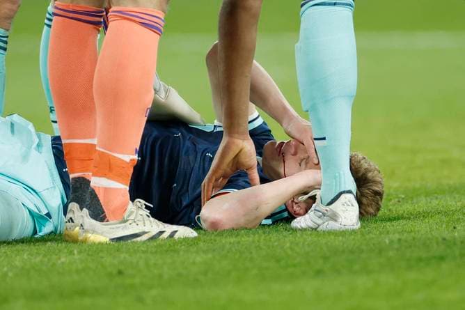 Kimmich hart getroffen